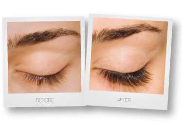eyelash-extensions-before-after